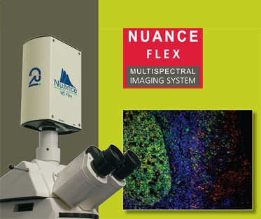 Nuance���H���VӰ�����VӰ��ϵ�y(t��ng)